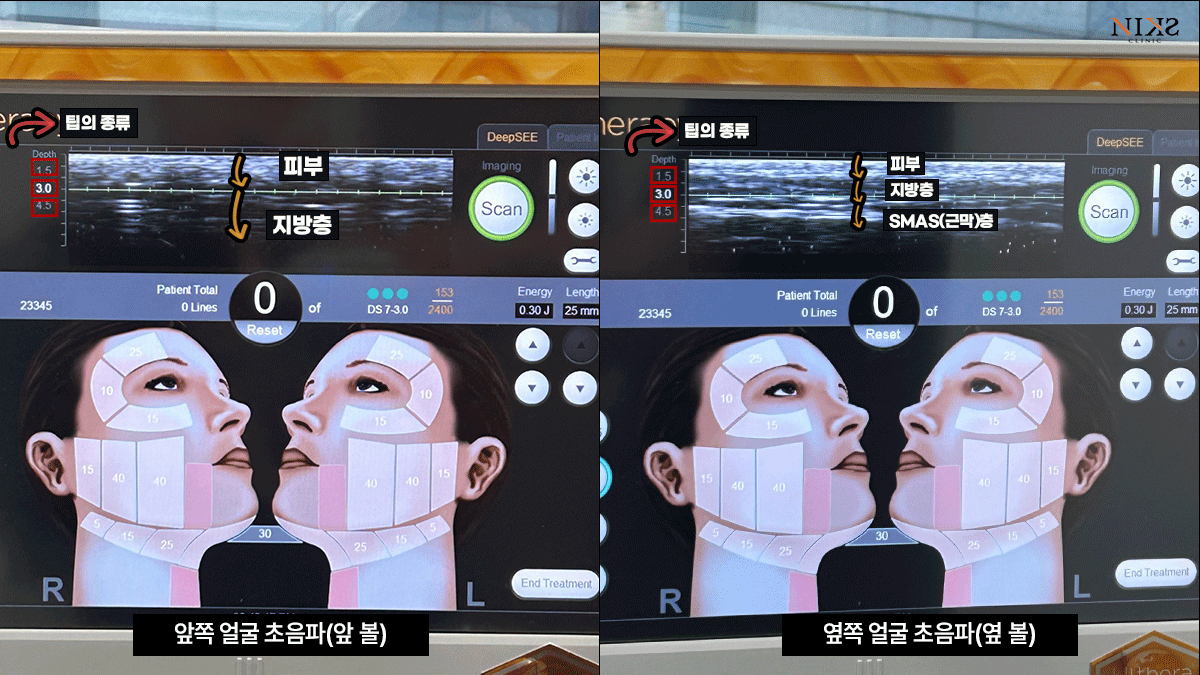 754bc8f456d2899752598931d40b3e58_1766808184_8807.gif 754bc8f456d2899752598931d40b3e58_1766808184_8807.gif