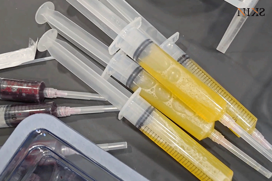 215c4f3e9c0423571930082926c3ca38_1768360900_6699.gif 215c4f3e9c0423571930082926c3ca38_1768360900_6699.gif