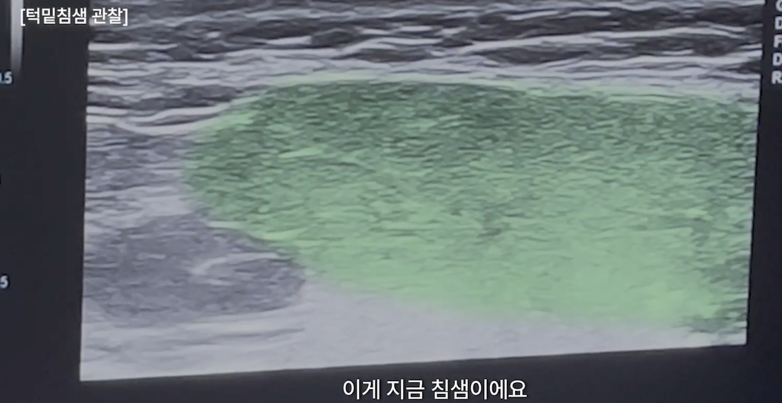 c32722c4cc4a8c0cee200685b6414d74_1769742104_1819.png c32722c4cc4a8c0cee200685b6414d74_1769742104_1819.png