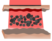 detailimg